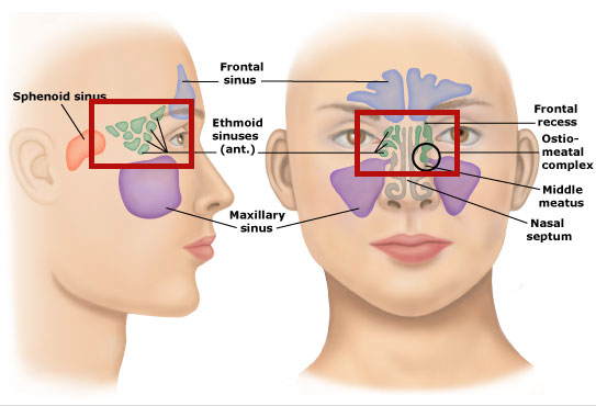 sinusite ethmoidale sinus ethmoïdale ethmoide ethmoïde nez bouché ostéo ostéopathie