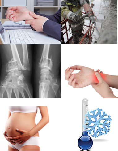facteurs favorisants syndrome canal carpien osteo osteopathie ostéo ostéopathie mouvements répétés vibrations blessures femmes enceintes kyste arthrite froid torsions main poignet